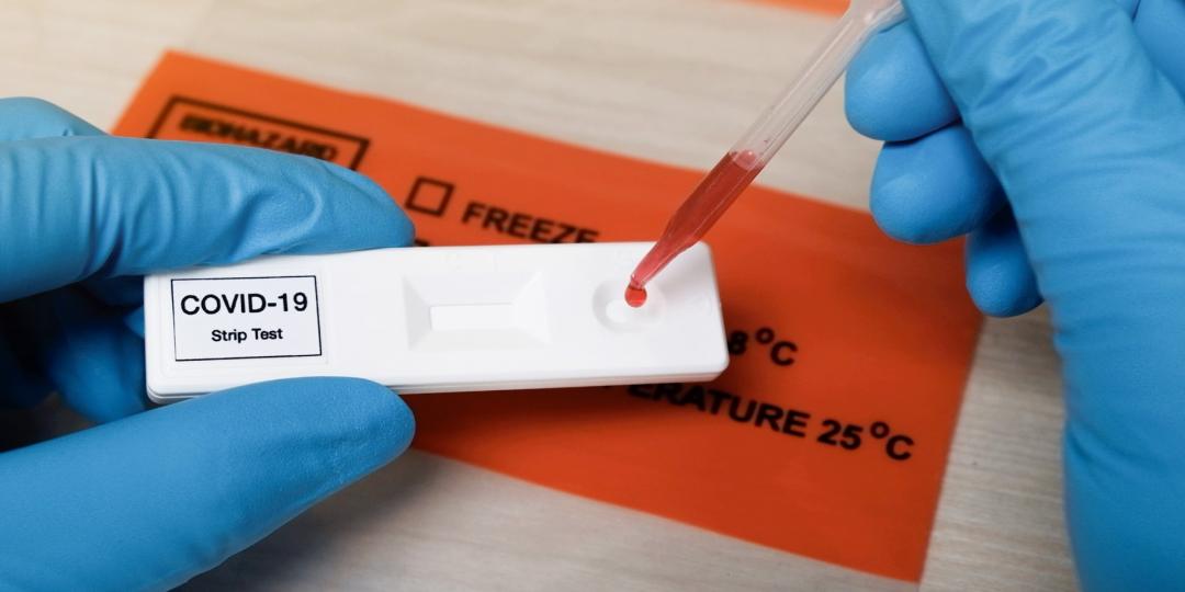 covidantigentest